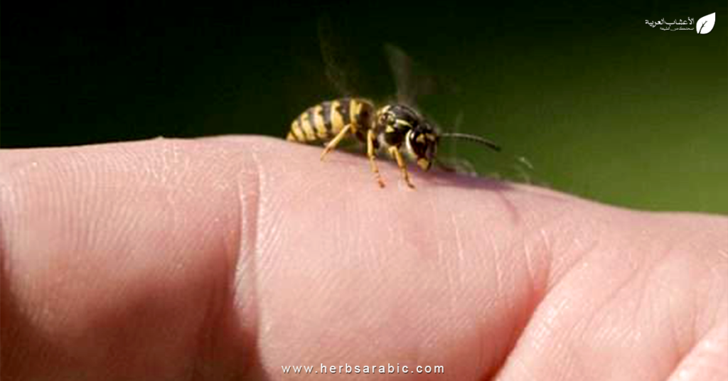 علاج قرصة النحل